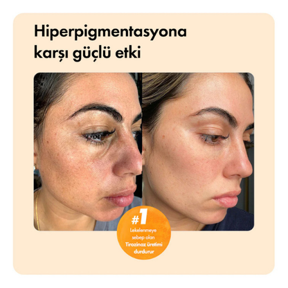 Kojik Asit Etkili Leke Karşıtı Bar