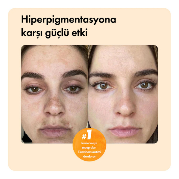 Kojik Asit Etkili Leke Karşıtı Bar