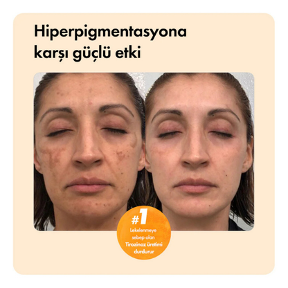 Kojik Asit Etkili Leke Karşıtı Bar